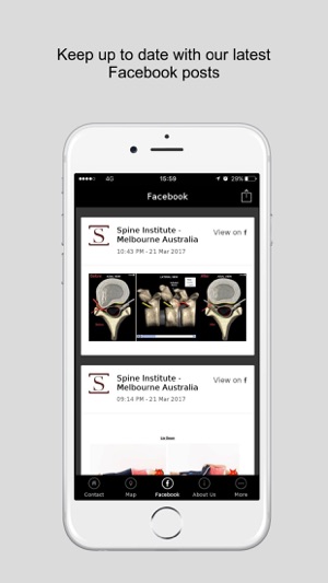 Spine Institute Pty Ltd(圖4)-速報App