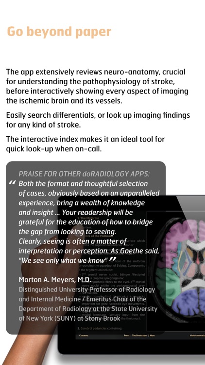 Diagnostic Radiology - Imaging in Stroke