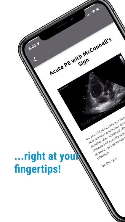 The POCUS Atlas