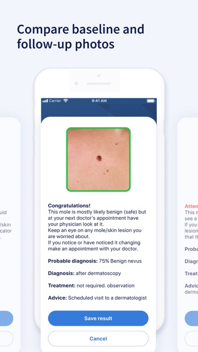 AI Dermatologist: Skin Scanner Screenshot