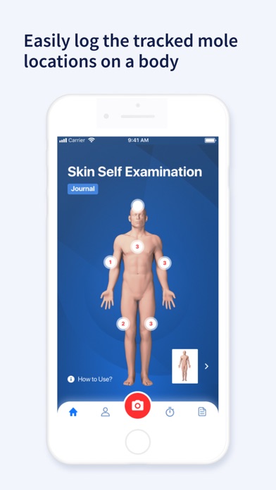 AI Dermatologist: Skin Scanner Screenshot
