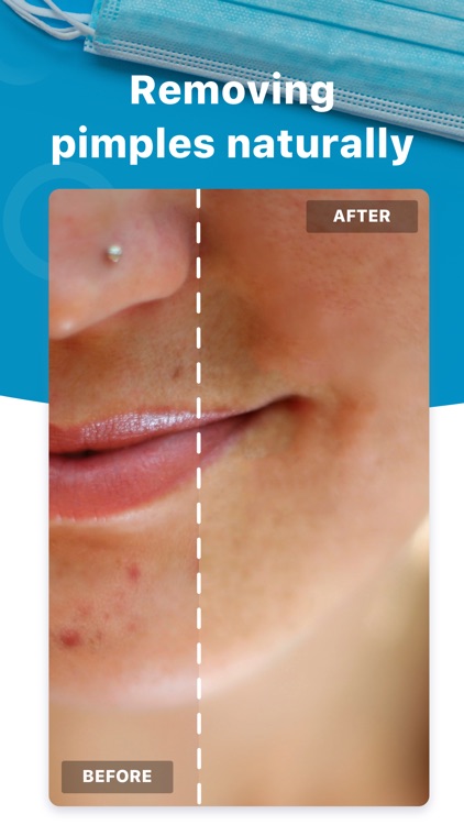 Blemish Editor - Face Tuner