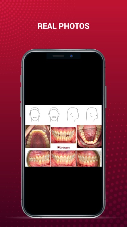 OrthoPic: HD Dental Images screenshot-6