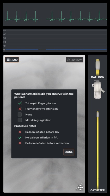 Mentice Right Heart Cath screenshot-3