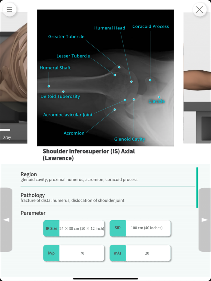 Navi Radiography Pro