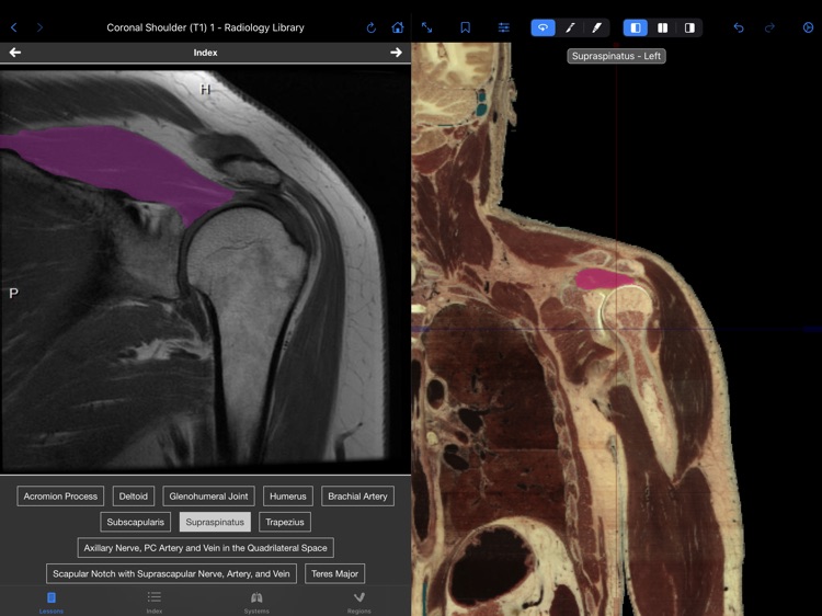 VH Dissector Pro screenshot-6