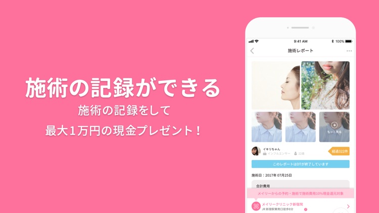 美容整形・美容医療の口コミ・予約アプリ 美容外科検索メイリー screenshot-6