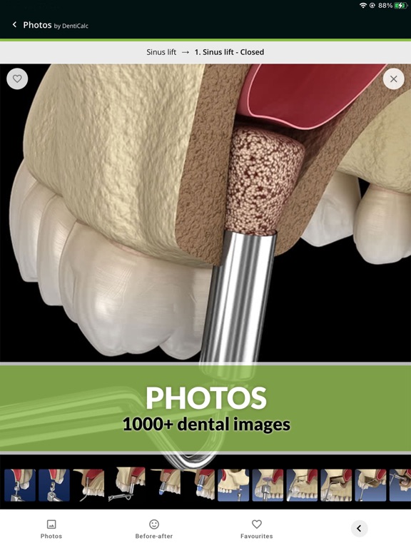DentiCalc 4in1: Dental Care