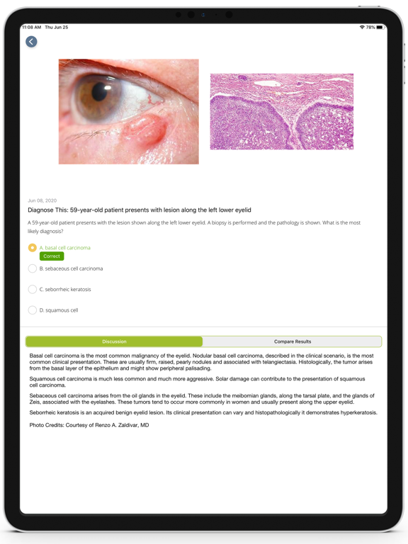 AAO Ophthalmic Education screenshot 4