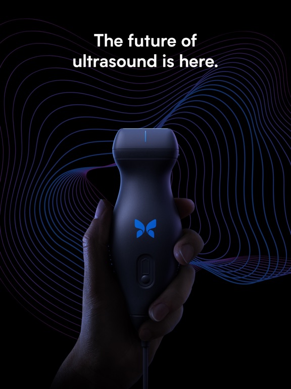 Butterfly iQ — Ultrasoundのおすすめ画像1