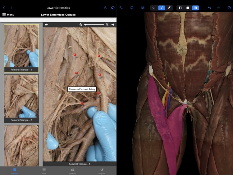 VH Dissector Pro screenshot-3