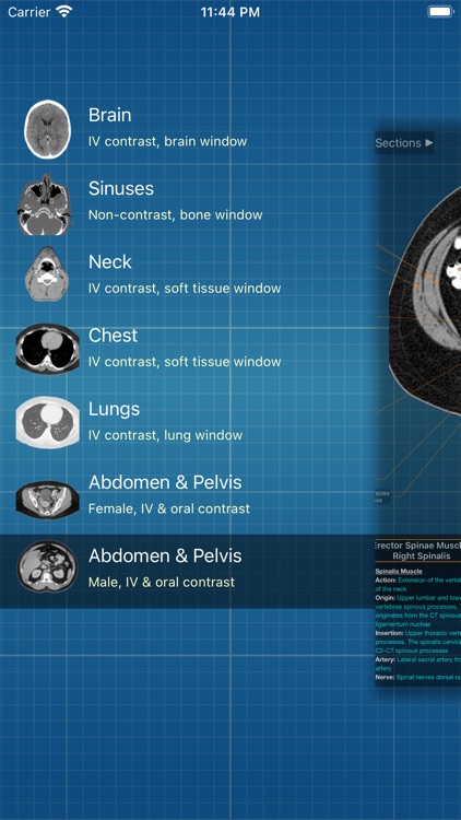 X-Anatomy Pro screenshot-0