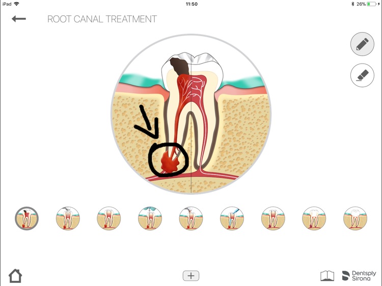 Endo IQ® App - Paraguay screenshot-6