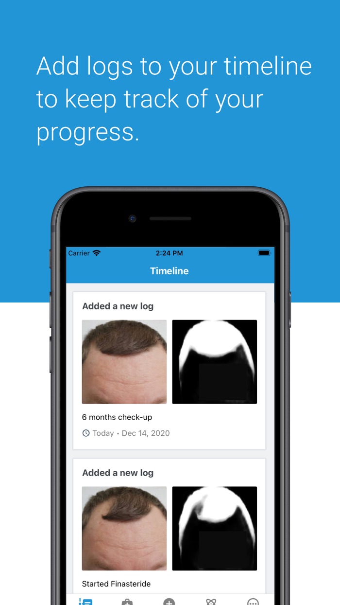 HairLog Hair Regrowth Tracker