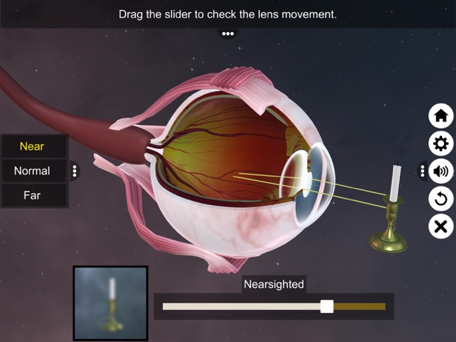 The Eye (Anatomy & Physiology) on the App Store