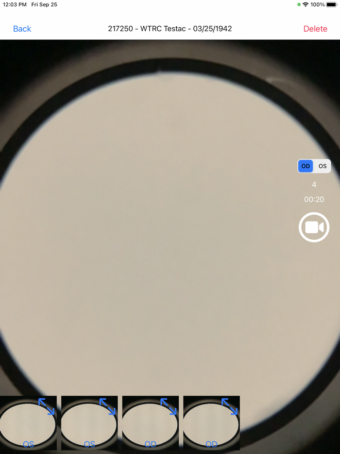 Brane SlitLamp Capture