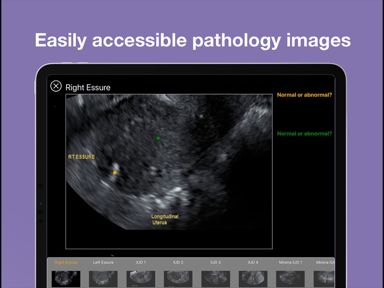 obNAV: Ultrasound Education screenshot-3