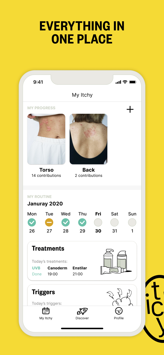 ITCHY - Psoriasis  Eczema