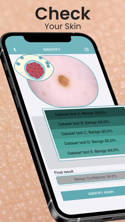 Skin Checker For Your Mole screenshot-0