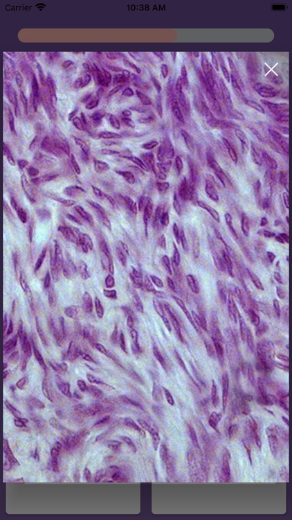 Skeletto screenshot-4