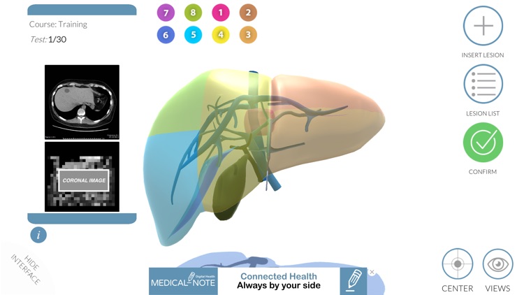 LIVER-NOTE.Edu