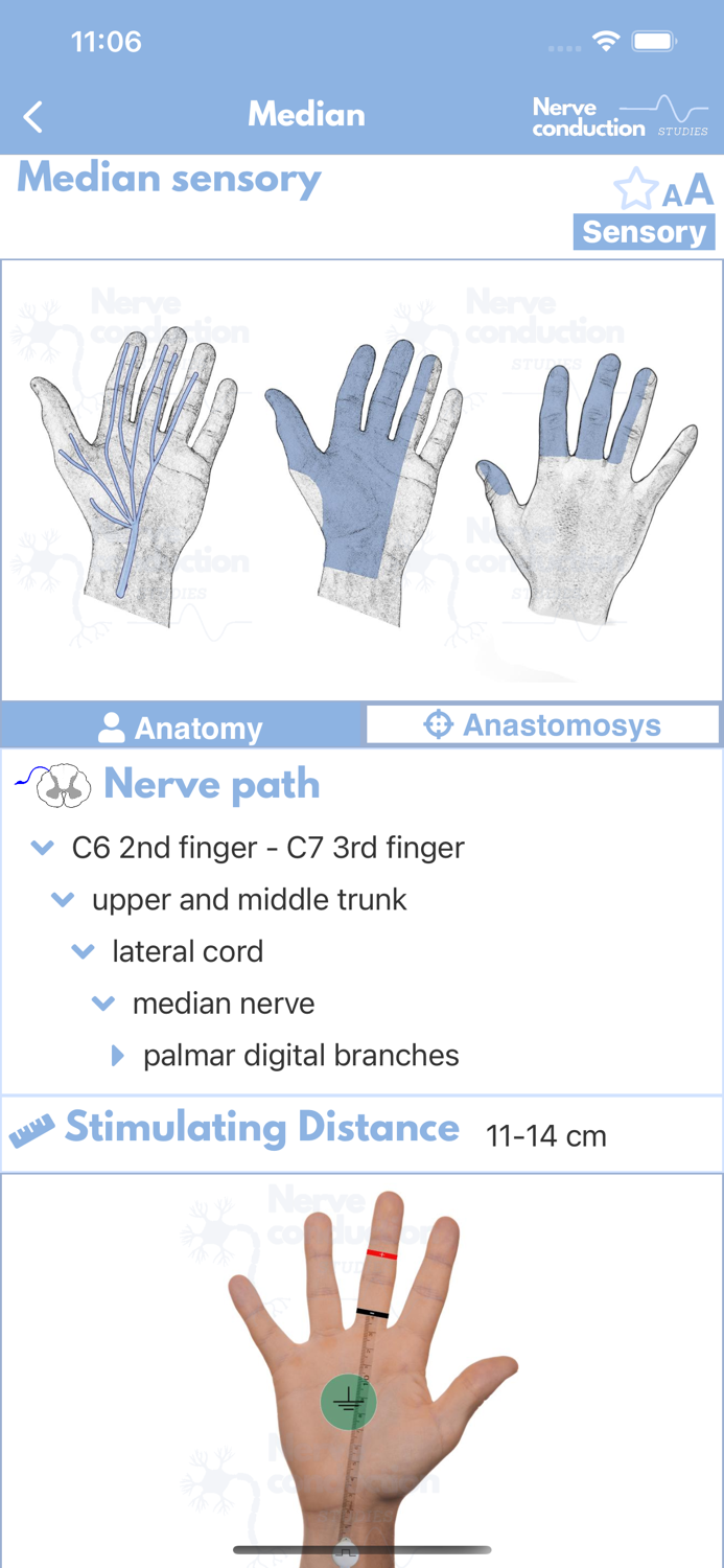 Nerve Conduction Studies