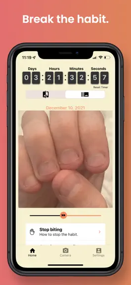 Game screenshot NailKeeper - Stop Biting Nails apk