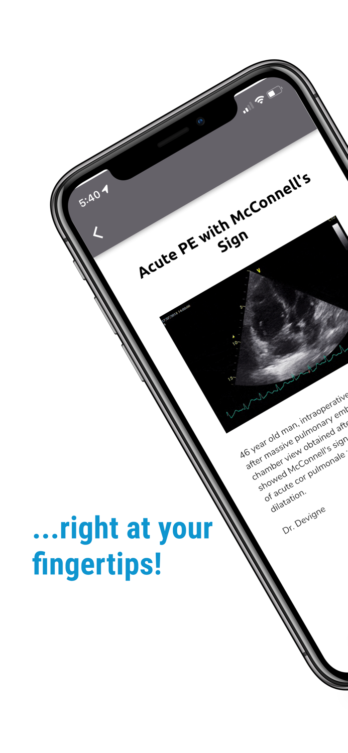 The POCUS Atlas