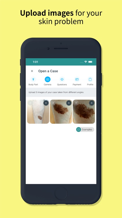 Skin Check: Dermatology App