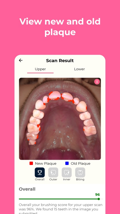 Testmyteeth