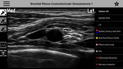 AnSo Anaesthesia Sonoanatomy AnSo Anaesthesia Sonoanatomy