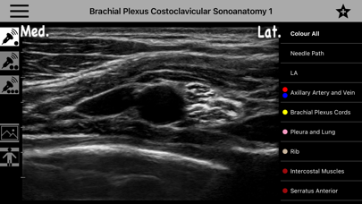 AnSo Anaesthesia Sonoanatomyのおすすめ画像9