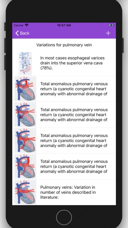 Vascular Variants