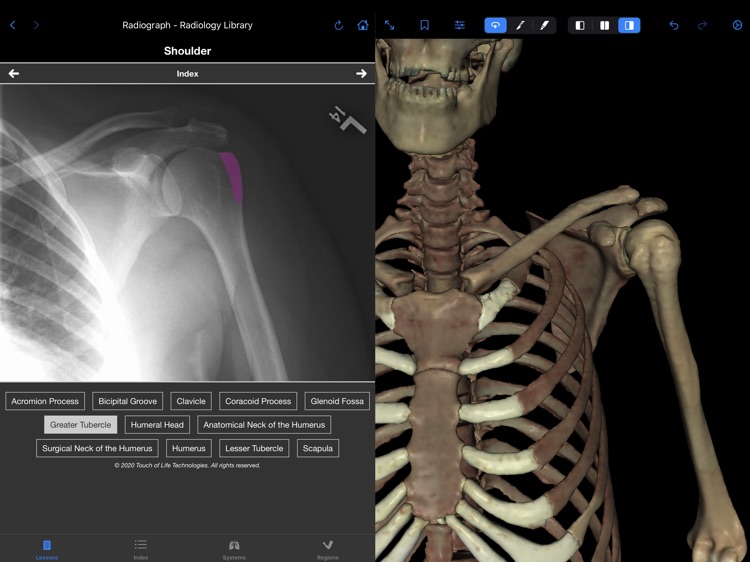 VH Dissector Pro screenshot-4