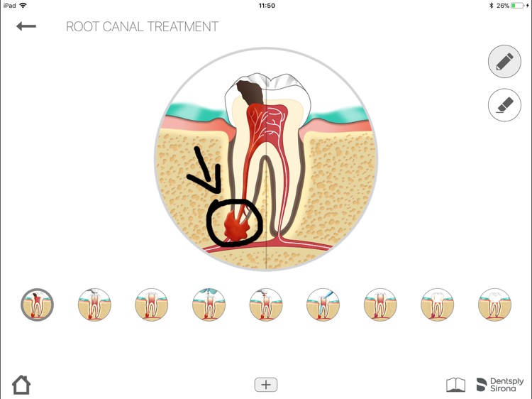 Endo IQ® App - South Korea screenshot-6