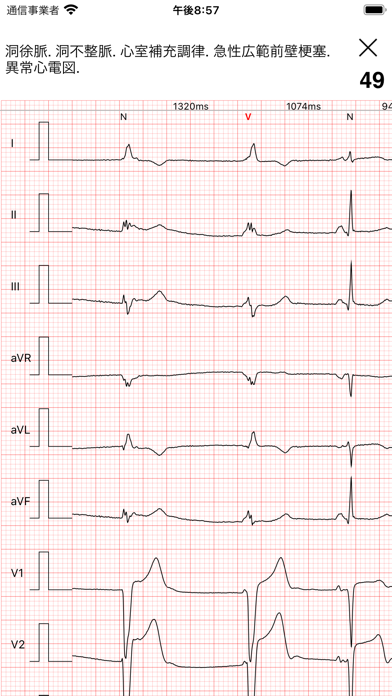 心電図ブック Pro Ecg Ekg Books Pc ダウンロード Windows バージョン10 8 7 22