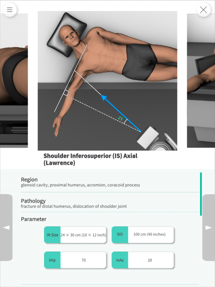 Navi Radiography Lite