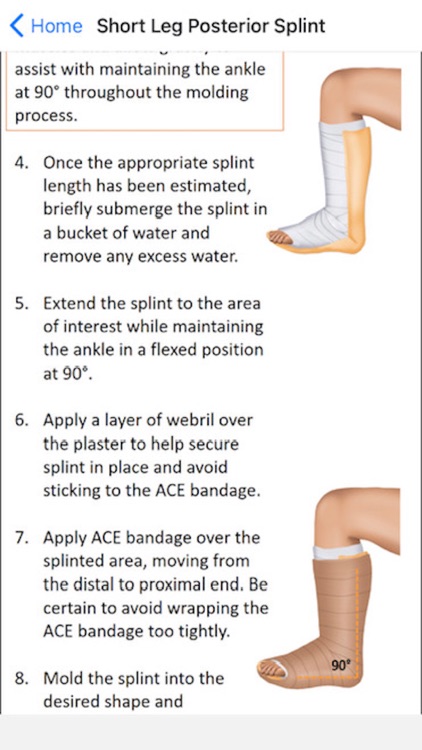 Splinting 101 screenshot-3