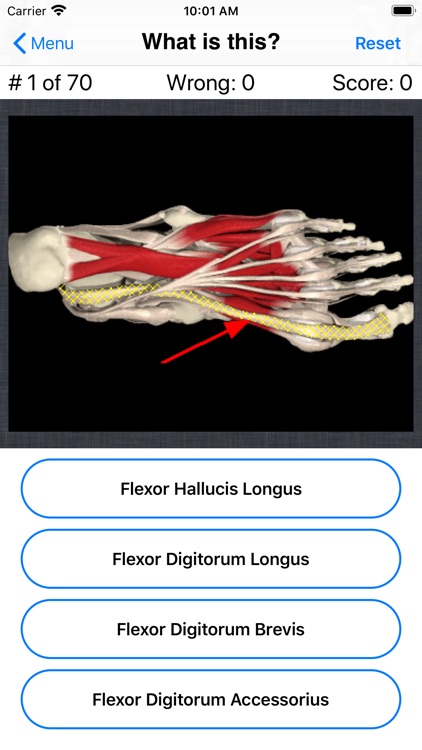Anatomy Foot Quiz screenshot-3