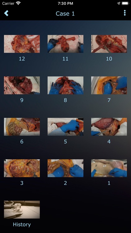 Autopsy