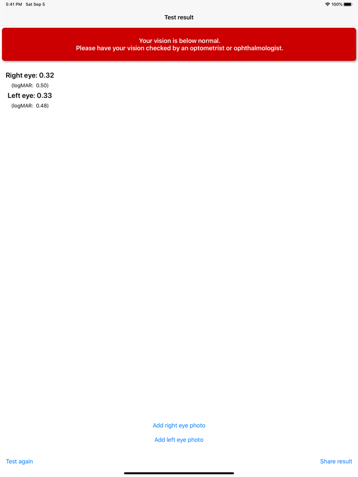 Eye Test - Visual Acuity