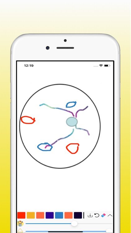 Eye Surgery Log screenshot-5