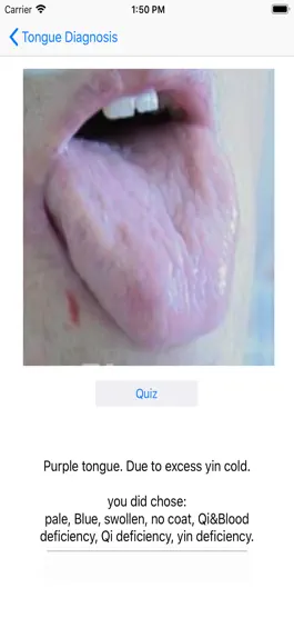 Game screenshot Tongue Diagnosis apk