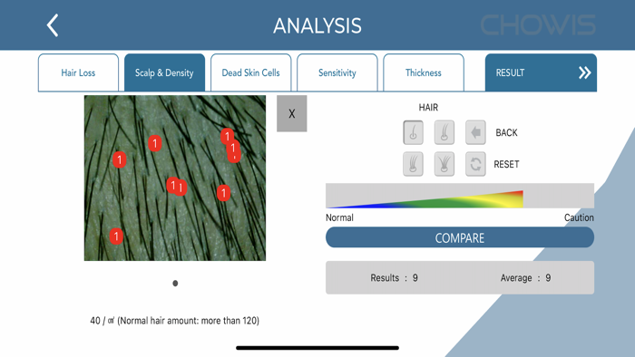 Chowis Hair Analyzer 2