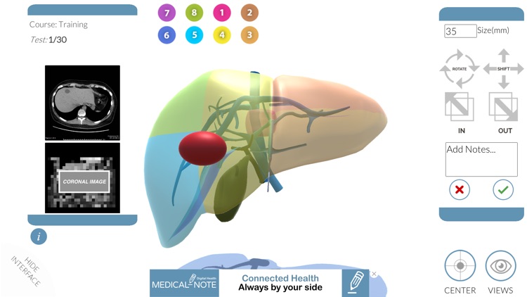 LIVER-NOTE.Edu