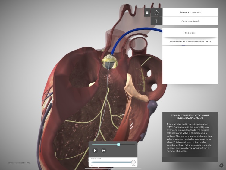 CardioShowroom (CSR) screenshot-7