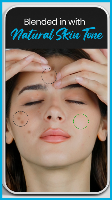 Blemish editor Pimple Remover screenshot 2