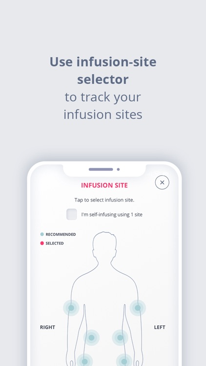 My Infusion Tracker™ screenshot-4