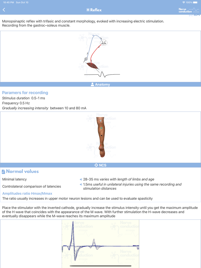 Nerve Conduction Studies