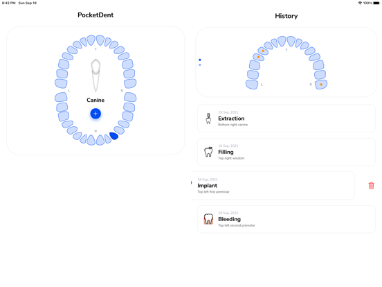 Screenshot #4 pour PocketDent